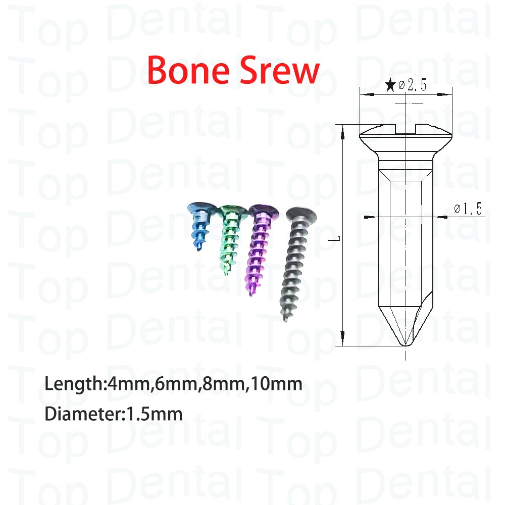 10pcs Dental GBR System Bone S - огляд і ціна Stabilizer Screw In
